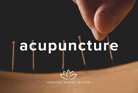 Acupuncture Billing Services